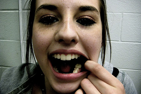 tooth (pl: teeth)